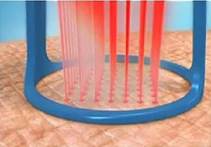 co2 laser annapolis md